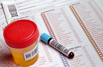 Kan ve İdrar Tahlili