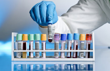 Laboratuvar Tetkitleri 